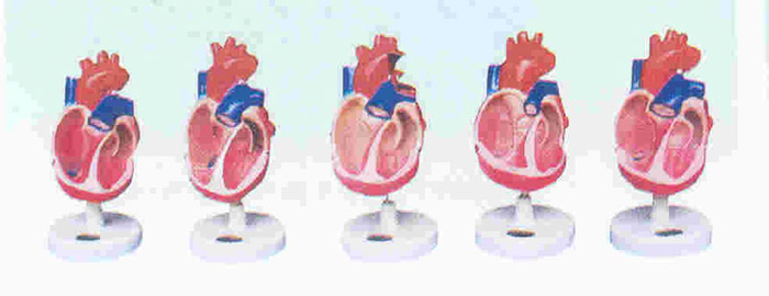 先天性心脏畸形模型