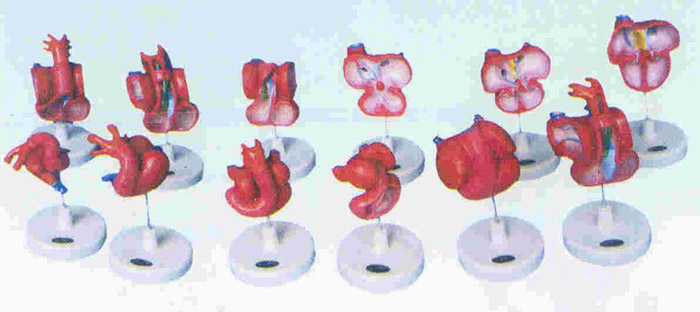 放大型活动心脏发生示教模型