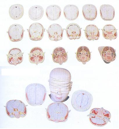 人体头颈部横切面断层解剖模型