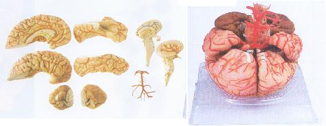脑动脉模型