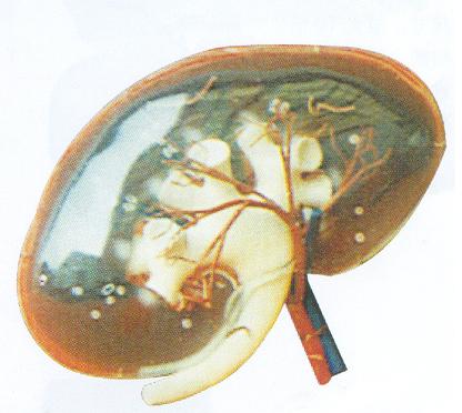 透明肾脏放大模型