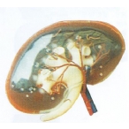 透明肾脏放大模型